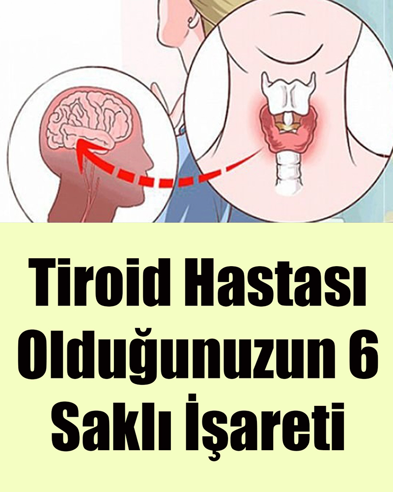 Tiroid Hastası Olduğunuzun 6 Gizli İşareti - 1