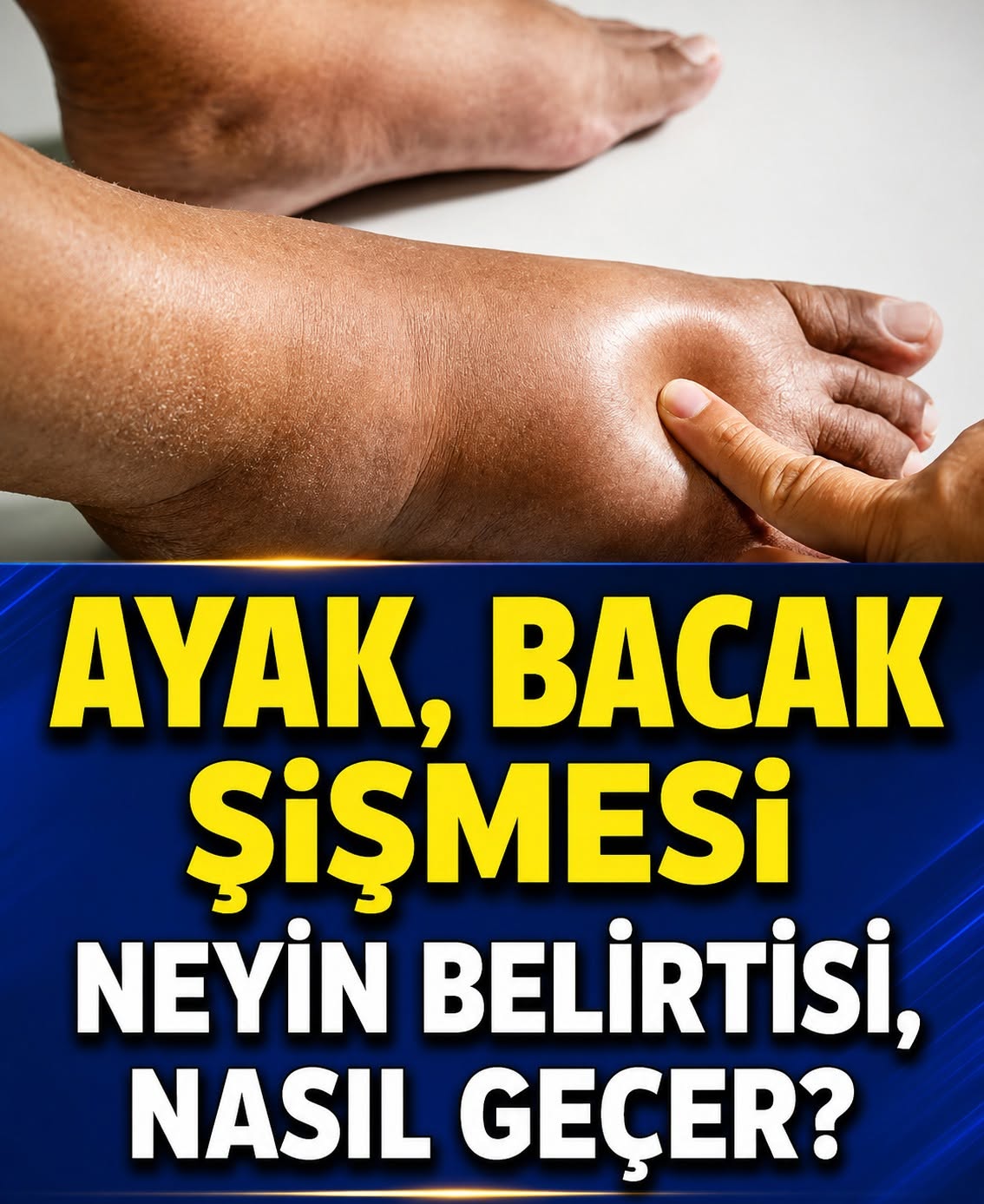 Ayak Bacak Şişmesi Neyin Belirtisi İlk Defa Duyacaksınız - 1