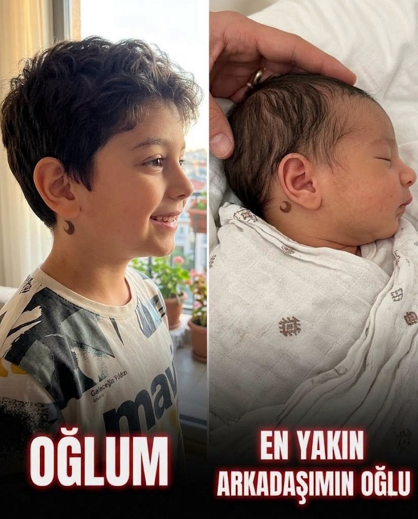 Arkadaşımın oğlu aynı nadir doğum lekesiyle - 1