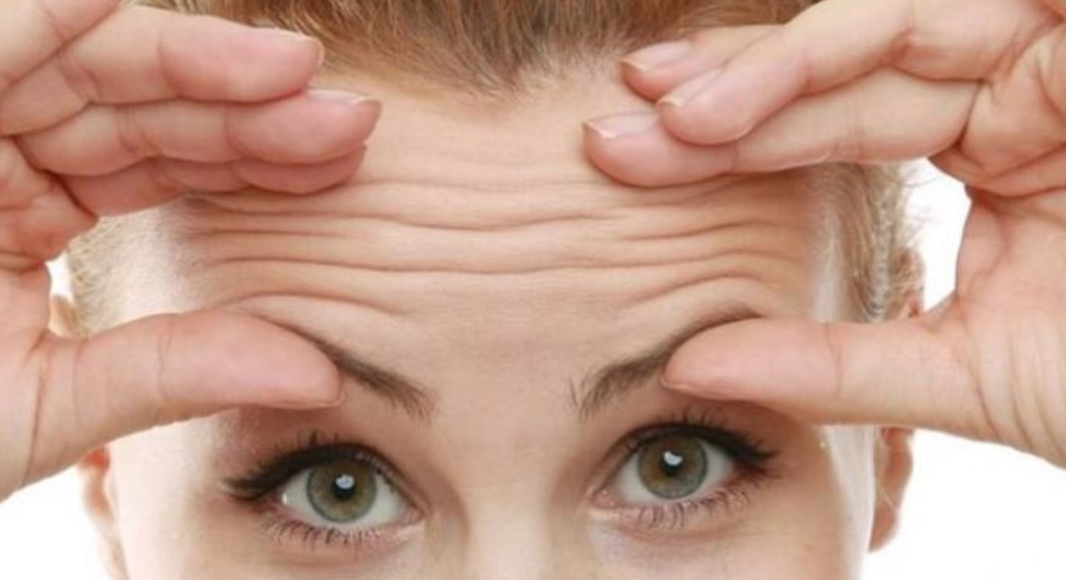 Alın Kırışıklıkları Nasıl Geçer, Giderilir? - 2