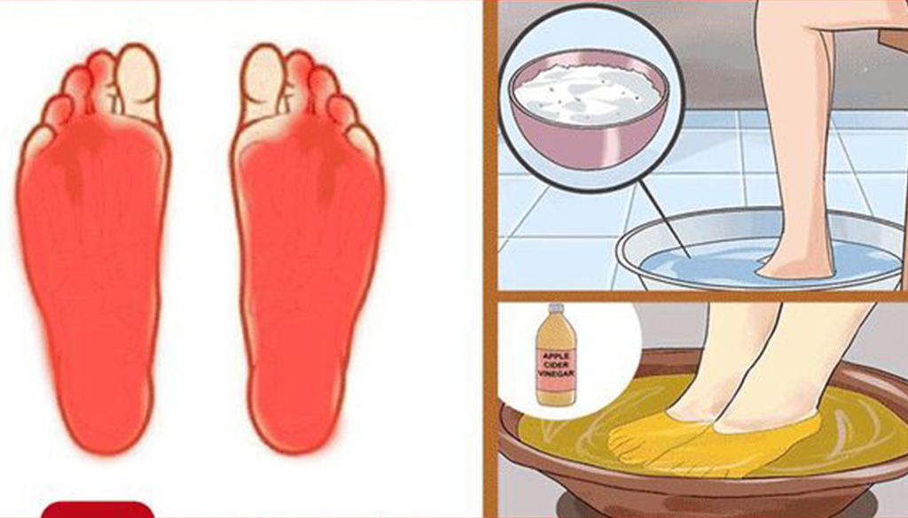 Ayaklarda Yanma Nedenleri - 3