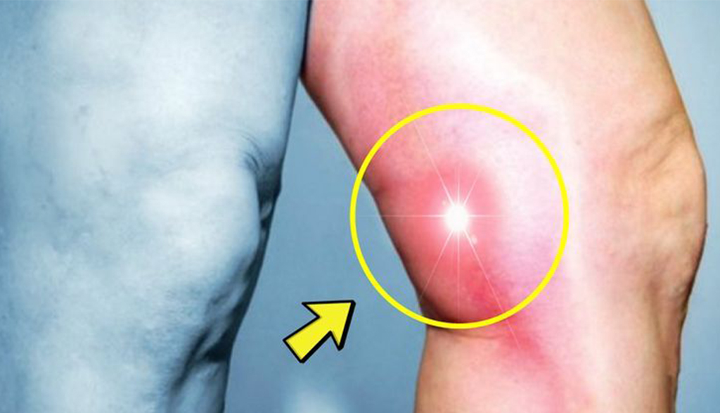 Bacak ağrısı neden olur, neyin belirtisi? - 4