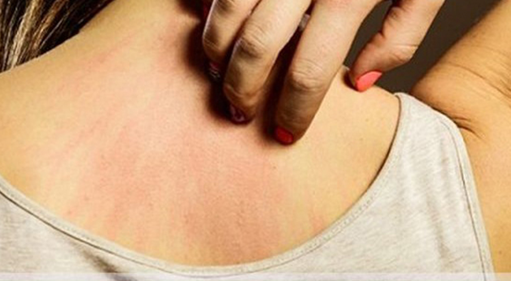 Kanser olduğunuzu nasıl anlarsınız işte belirtileri - 2