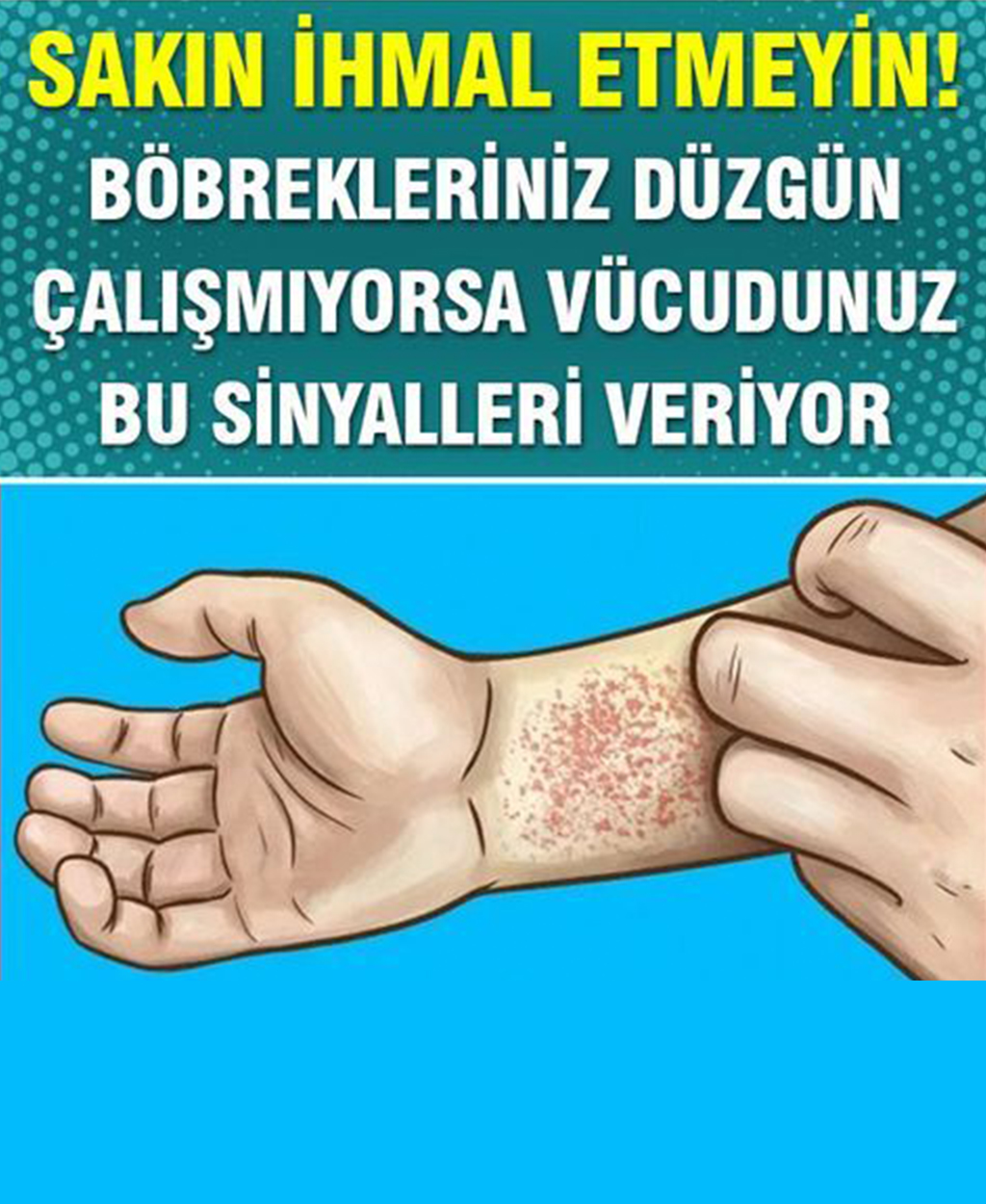 Böbreklerinizin Düzgün Çalışmadığını Gösteren Belirtiler - 1