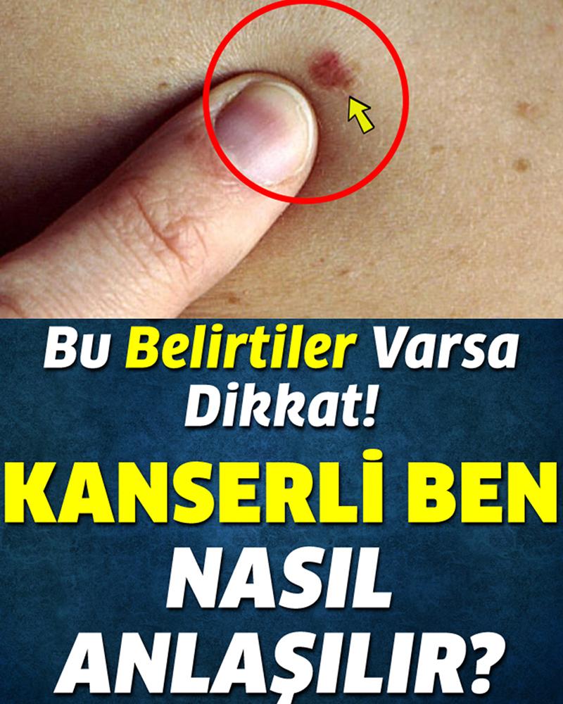 Bu Belirtiler Varsa Dikkat Nasıl Anlaşılır - 1
