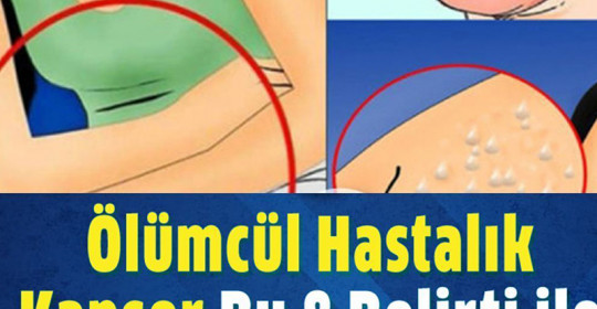 Kanserin Vücuda Verdiği 8 Belirti