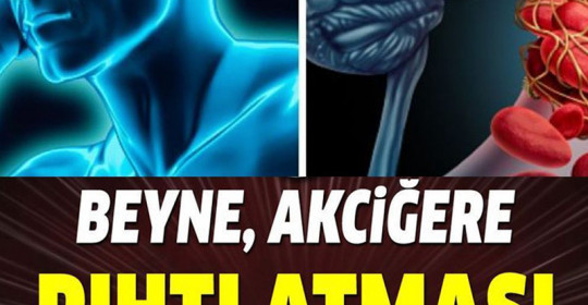 Pıhtı Atması Belirtileri Nelerdir	