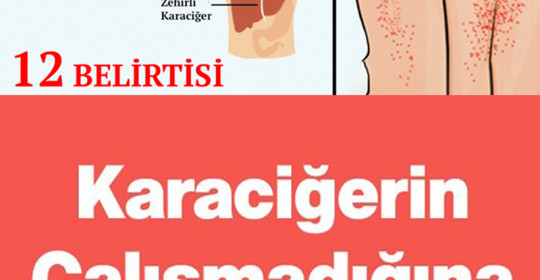 Karaciğerin Çalışmadığını Gösteren 12 Belirti	