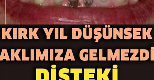 Evde Tartar Lekelerinden Nasıl Kurtulursunuz?