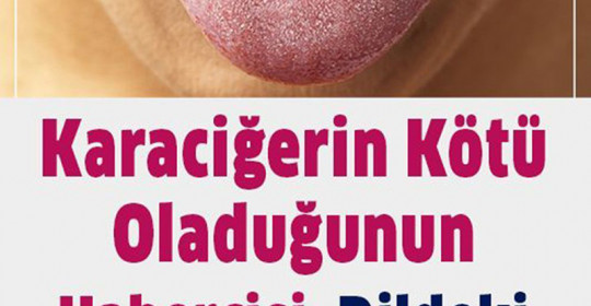Karaciğerinizin kötü olduğuna işaret eden dildeki beyazlığı bitiren yöntem