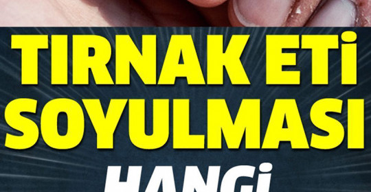 Tırnak Soyulması Hangi Hastalığın Belirtisi