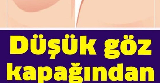 Bu Yöntemi Uygulayanlar Düşük Göz Kapağından Kurtulur