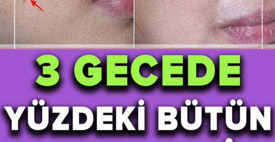 İki Malzemeli Bu Tarif Yüzünüzdeki Lekeleri 3 Gecede Geçiriyor