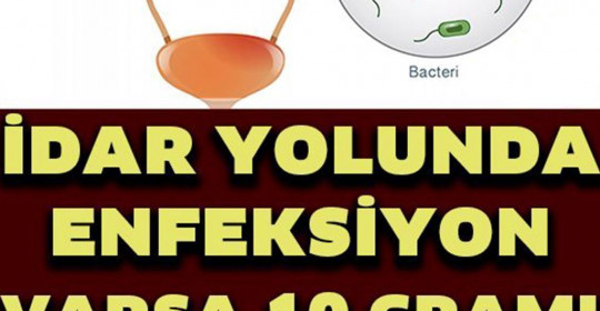 İdrar Yolu Enfeksiyonunu Geçiren 7 Doğal Yöntem