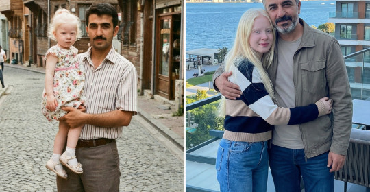 On üç yıl önce acil serviste çömez bir hemşireyken, trafik kazasında anne babasını kaybeden 3 yaşındaki Aslı ile tanıştım