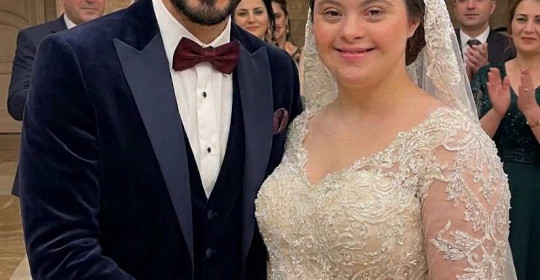DOWN SENDROMLU KIZ KARDEŞİMLE EVLENDİ