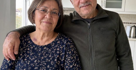 Annem Yıllarca Kollarını Uzun Kollu Kıyafetlerin Altına Sakladı