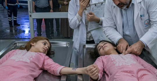 İkiz kızların zayıf kahkahalarını duyunca şoke oldu