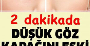 Düşük Göz Kapağını Eski Haline Getirmenin Püf Noktası