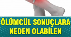 Kan Pıhtılaşmasının 8 Erken Belirtisi