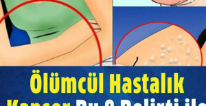 Kanserin Vücuda Verdiği 8 Belirti