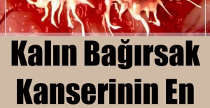 Kalın Bağırsak Kanserinin En Büyük Bulgusu	