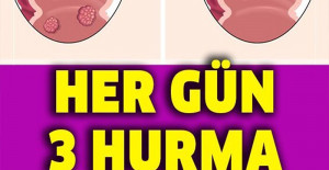 Her Gün 3 Hurma Yiyenin Başına Bunlar Geliyor	