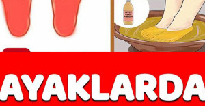 Ayaklarda Yanma Sebepleri
