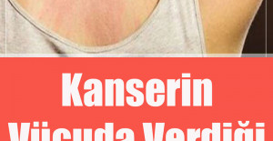 Kanserin Vücuda Verdiği 9 Belirti