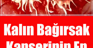 Kalın Bağırsak Kanserinin En Büyük Belirtisi Bu