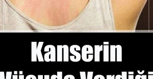 Kanserin Vücuda Verdiği 10 Belirti