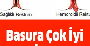 Basura iyi gelen inanılmaz yöntem