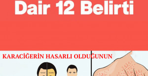 Karaciğerin Çalışmadığına Gösteren 12 Belirti
