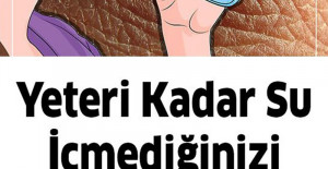 Yeteri kadar su içmediğinizde başınıza bunlar gelir