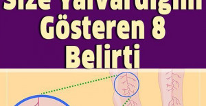 Vücudunuzda Magnezyum Eksikliğini Gösteren 8 Belirtisi	