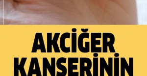 Akciğer Kanserinin En Sinsi 9 Bulgusu