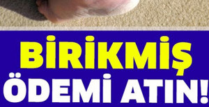 Bedeninizdeki Birikmiş Ödemi Atmak Ne Kadar Faydalı?