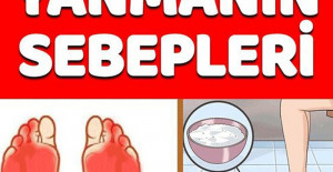 Ayaklarda Yanma Sebepleri