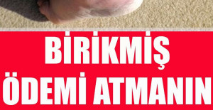 Birikmiş Ödemi Atmanın En Doğal Çaresi