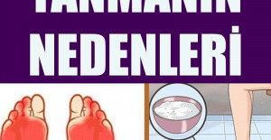 Ayaklarda Yanma Nedenleri