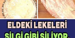 Eldeki Lekeleri Silgi Gibi Siliyor, Ben Deneyince Çok Şaşırdım