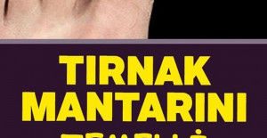 Tırnak Mantarını Temelli Yok Eden Doğal Yöntem	