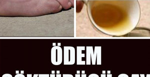 Ödem Söktürücü Çay Tarifi
