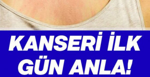 Kanser olduğunuzu nasıl anlarsınız işte belirtileri	