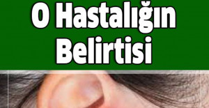 Kadınlarda Daha Çok Görülen O Hastalığın Belirtisi