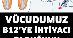 Vücudumuz B12’ye İhtiyacı Olduğunu Böyle Anlatır