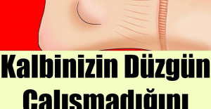Kalbinizin Düzgün Çalışmadığını Gösteren Belirtiler
