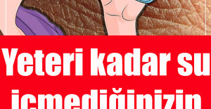 Yeteri kadar su içmediğinizin 8 belirtisi