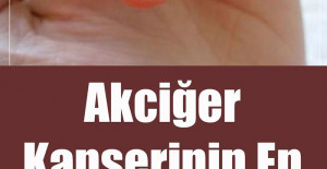 Akciğer Kanserinin En Sinsi 9 Belirtisi