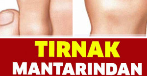 Tırnak Mantarından Kurtulmak Bu Kadar Basitmiş